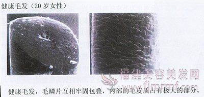健康毛发的(de)毛鳞片-毛发构造 健康毛发的毛鳞片-毛发构造